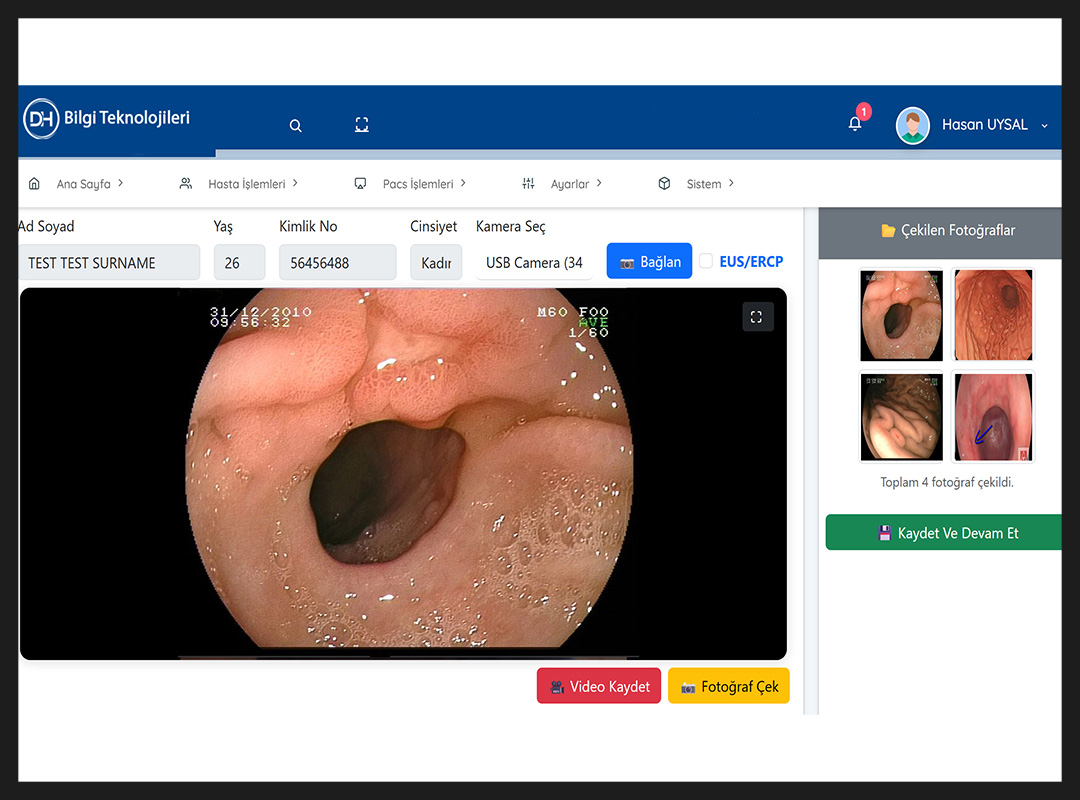 Endoskopi Yazılımı